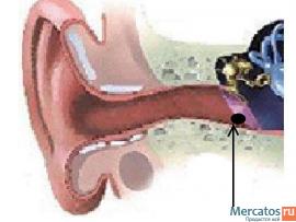 Беспроводные микронаушники хенс для сдачи экзамена