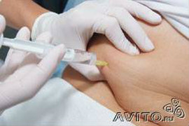 Биоревитализация, Ботекс, Мезотерапия Частный дипломированный вр 3